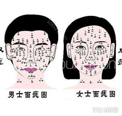 如何消痣|面部去痣的最好方法